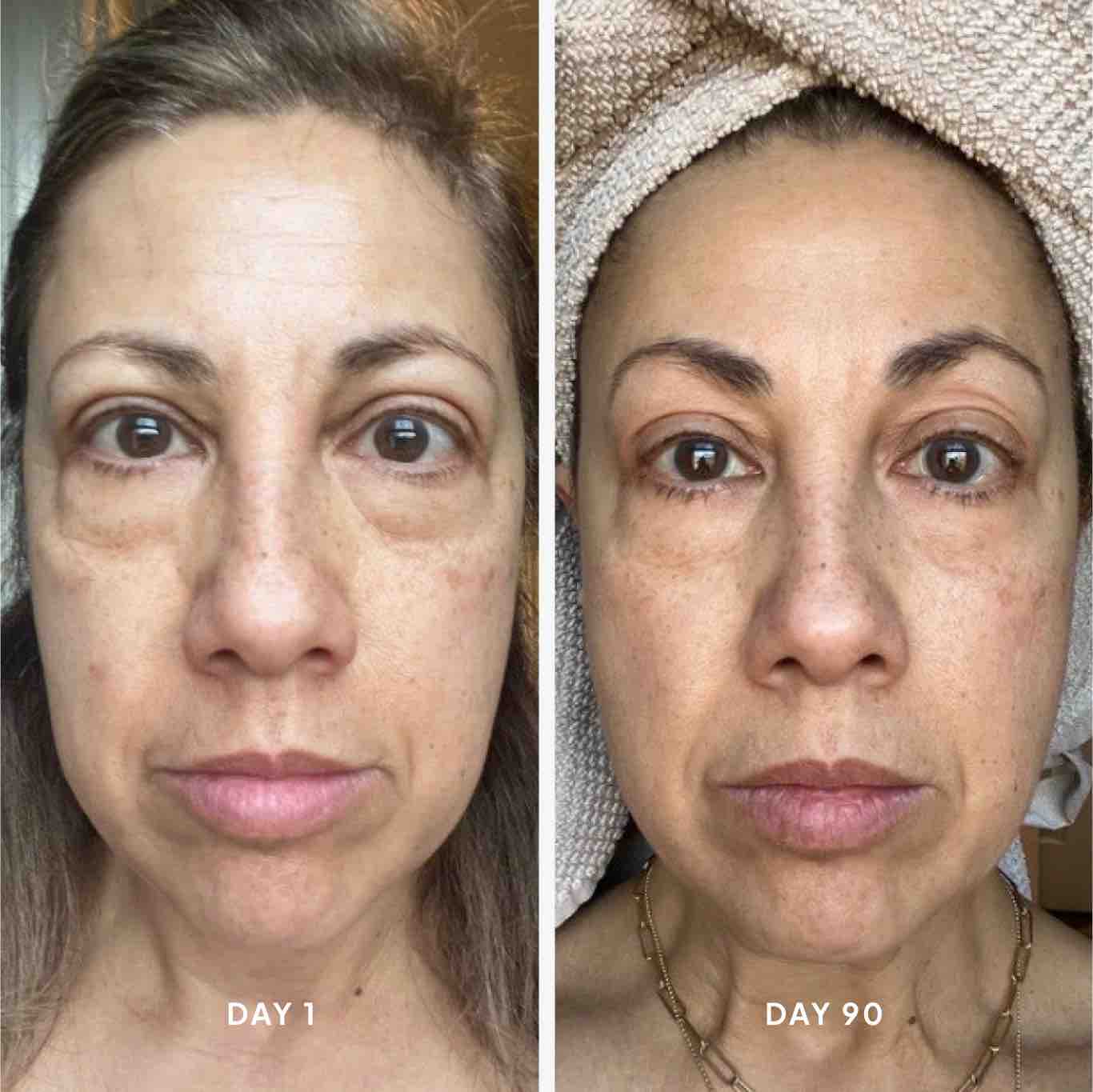 
                  
                    Collagen Boosting Hydrofiller Capsules
                  
                